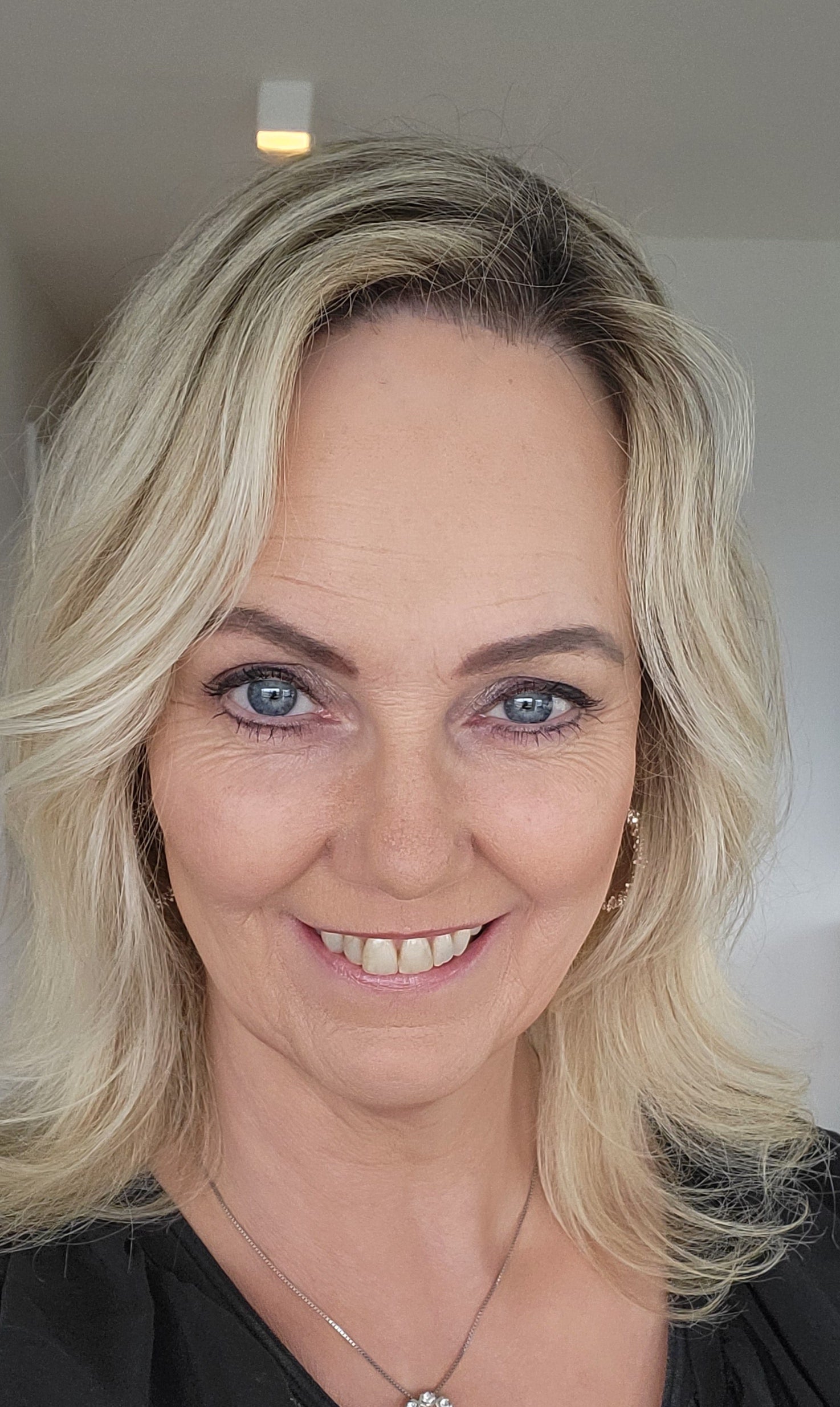 Útbrotin og yfirborðsþurrkurinn að hverfa
