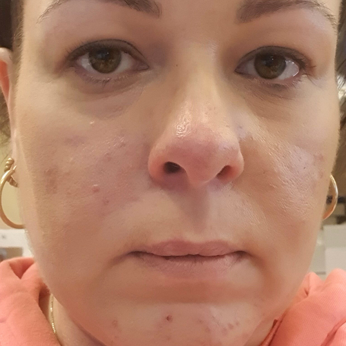 After - Hrafnhildur Viðarsdóttir